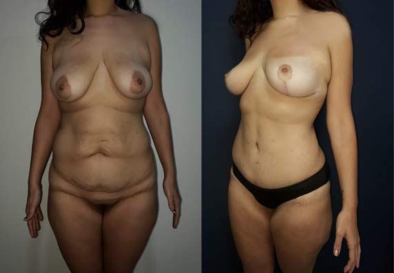 Edgar Ernesto Torres Mejía-6