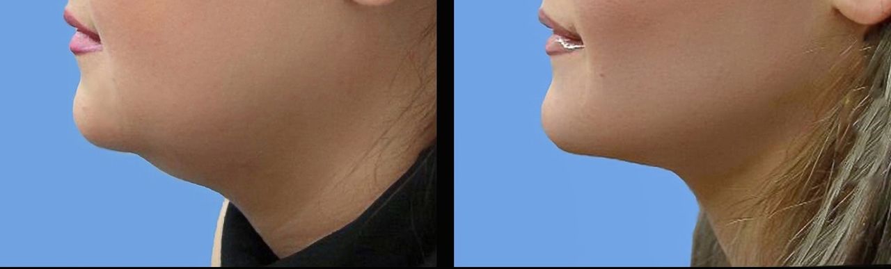 Ruby Lizardo Ramírez Robles-13