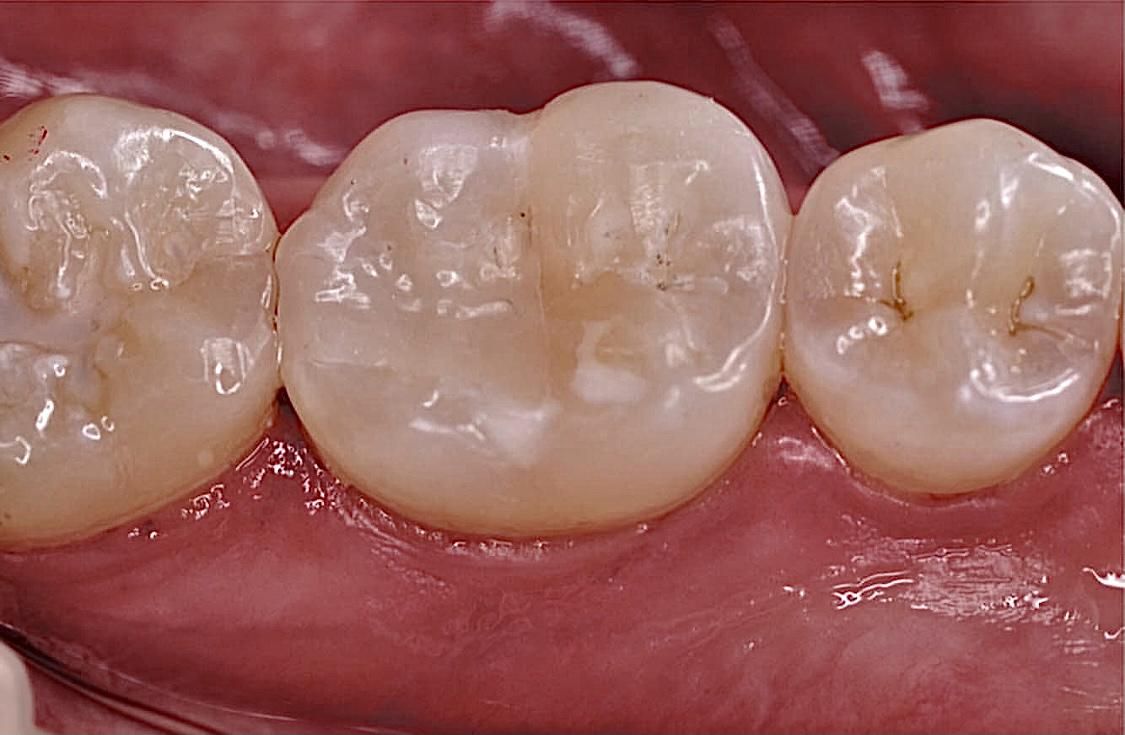 José Alberto Martínez Basulto-25