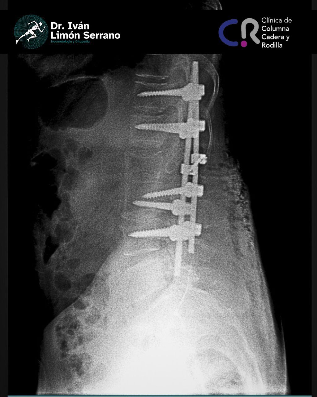 Iván Limón Serrano-25