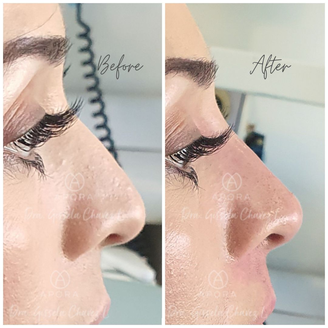 Gissela Chávez Lizardi-13