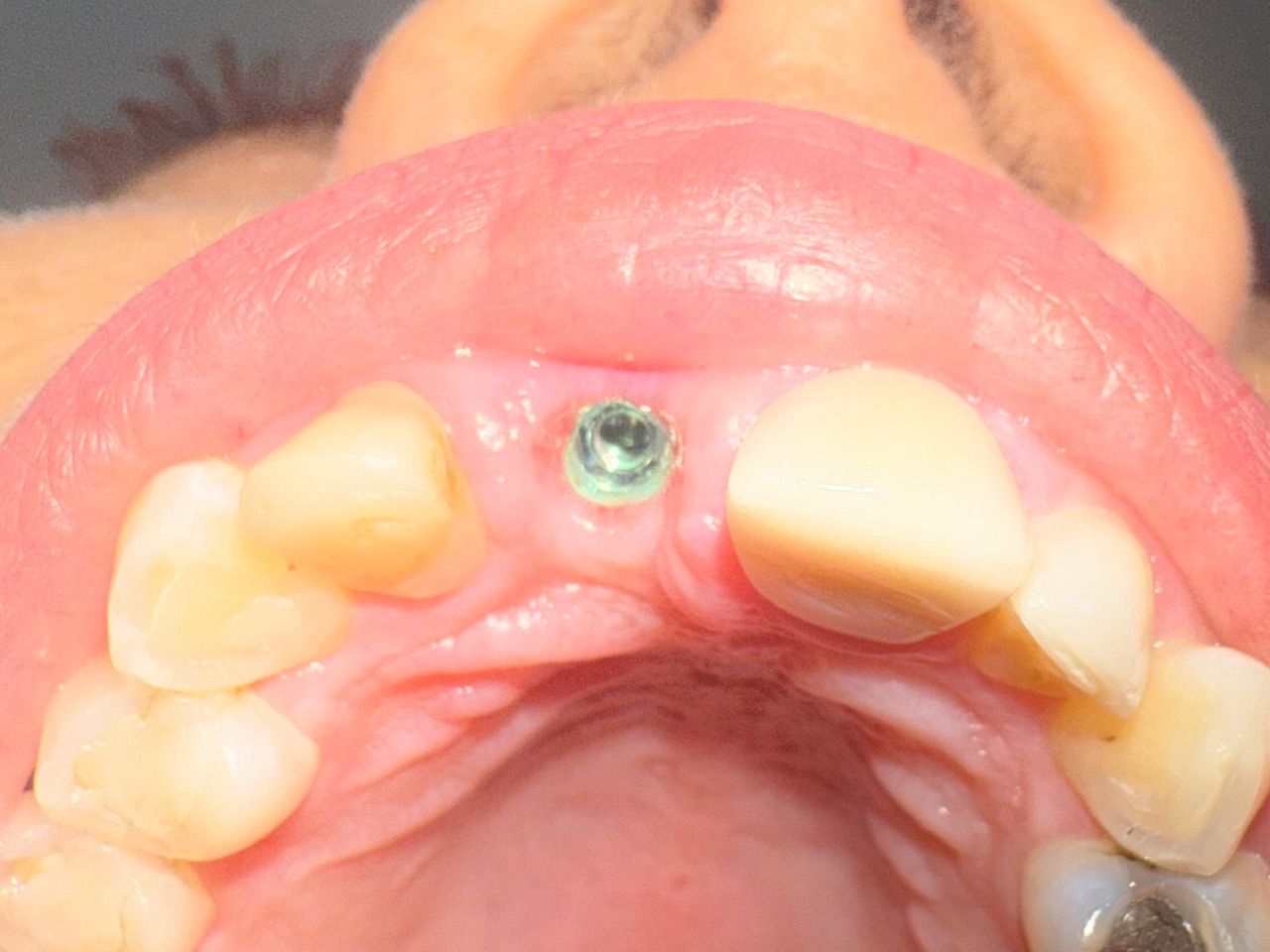 Jair Contreras García-57