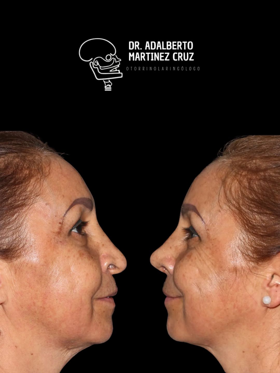 Adalberto Martínez Cruz-8