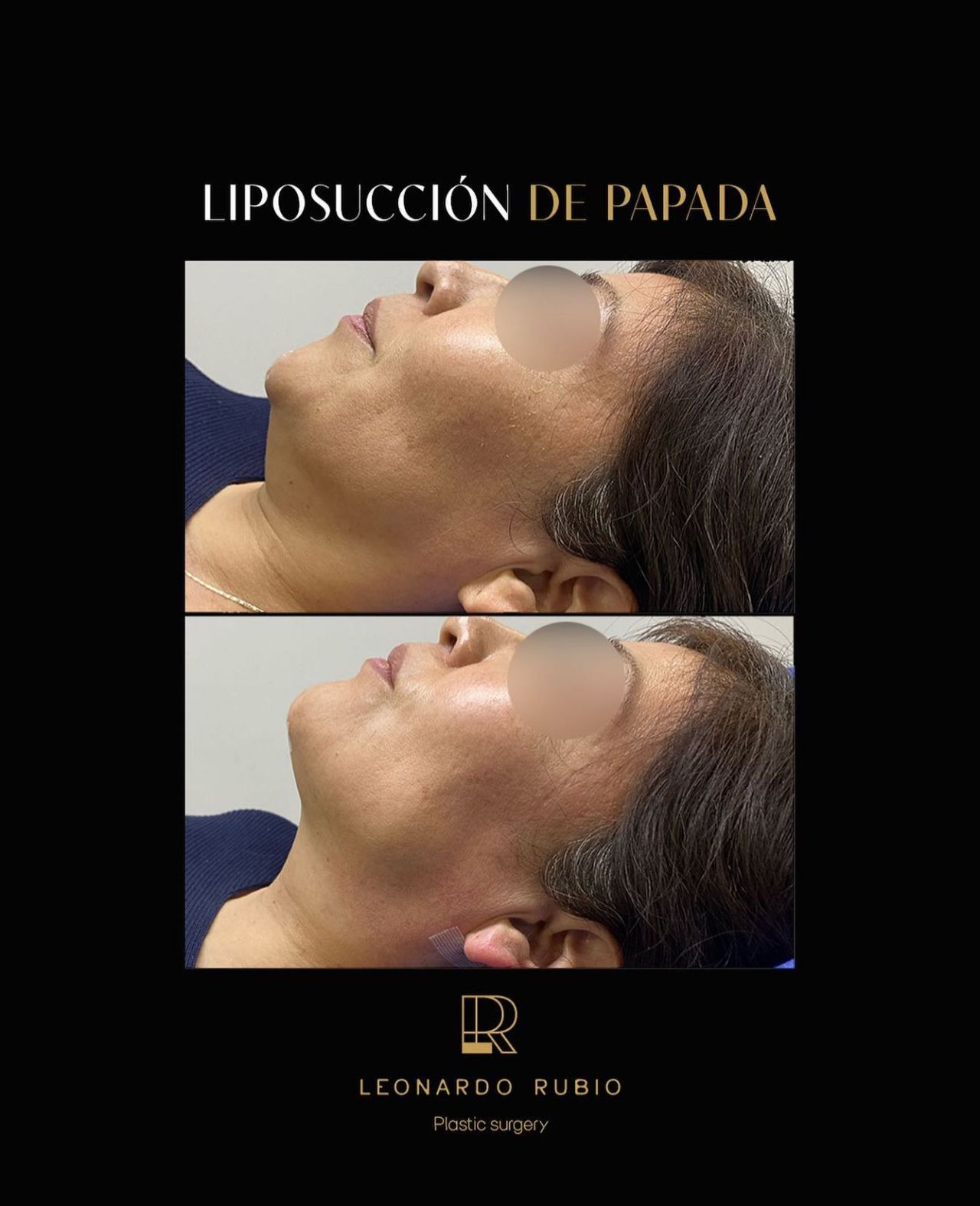 Leonardo Rubio Gomez-4