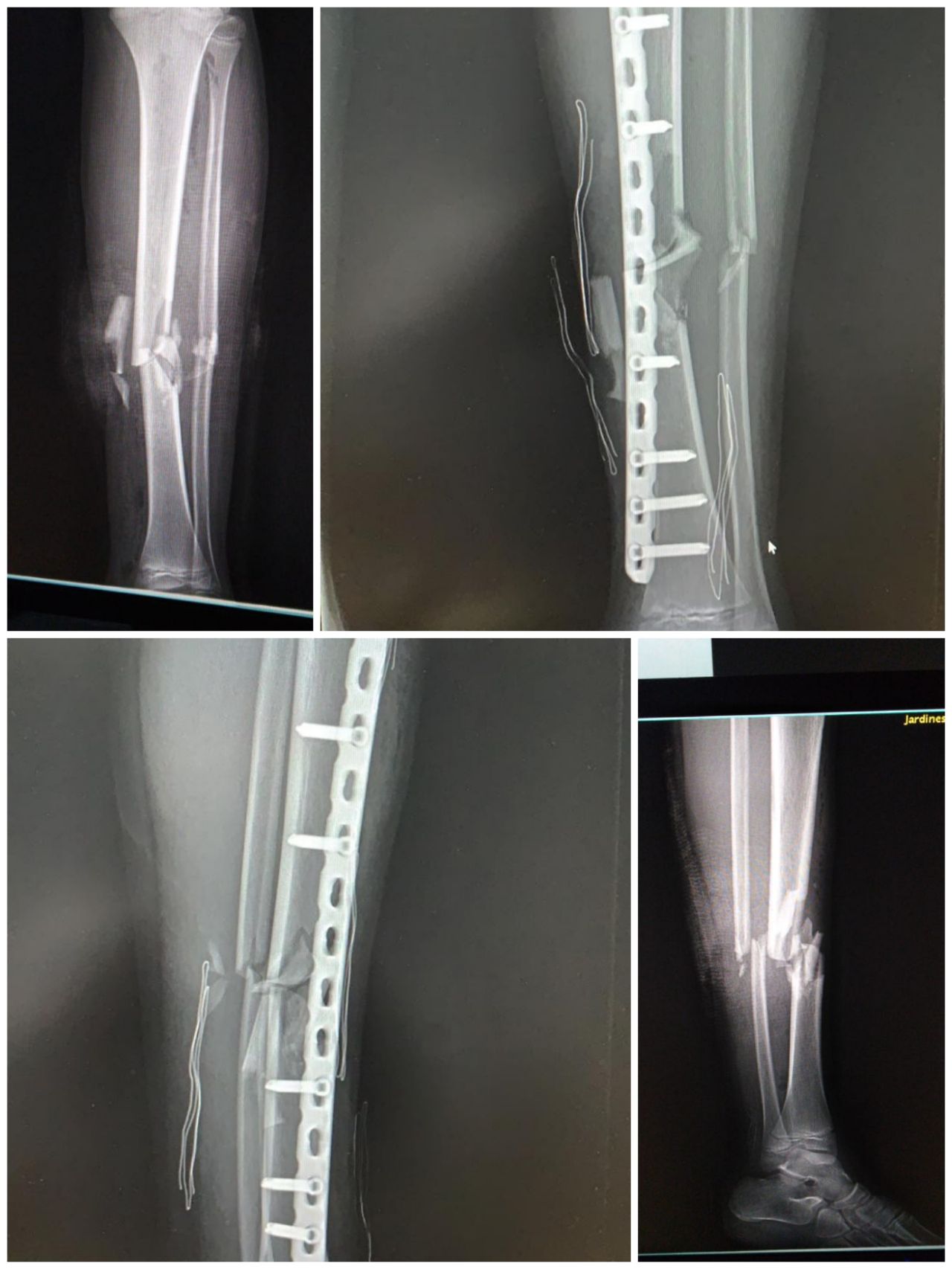 Gabriel De Leon Ochoa Lara-7