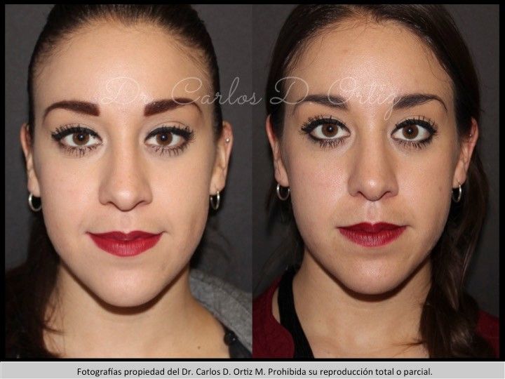 Carlos David Ortiz Moreno-45