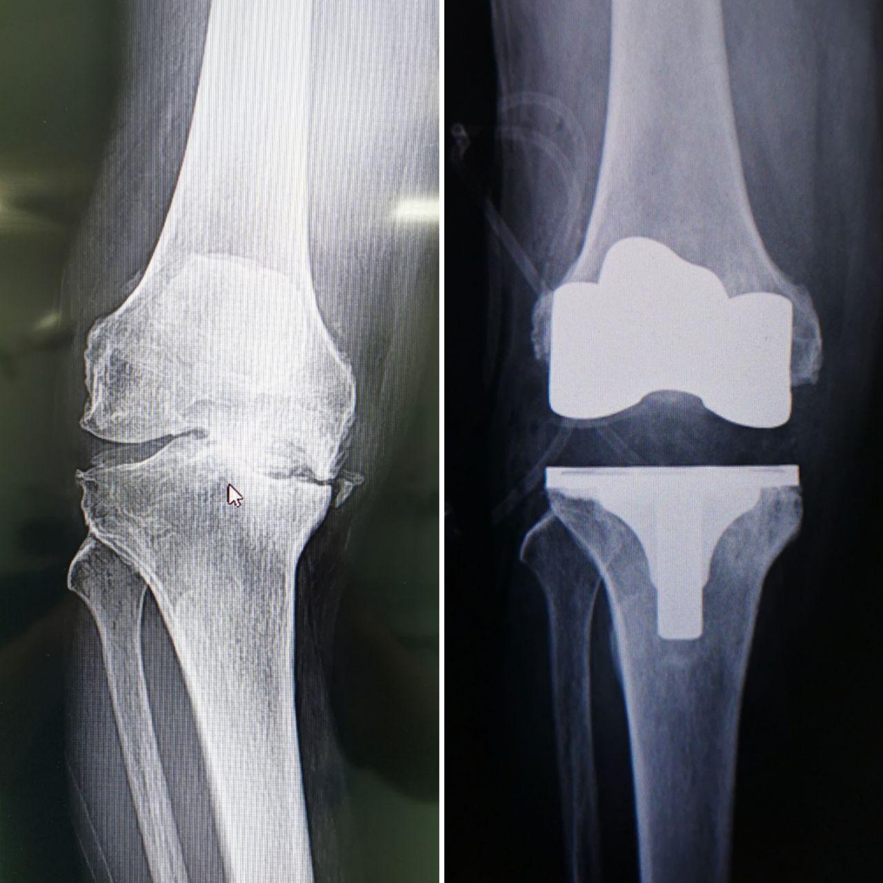 Avelino Colín Vázquez.-4