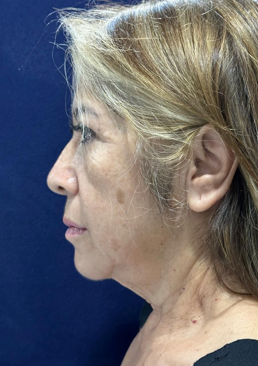 Porfirio Castillo Campos-1