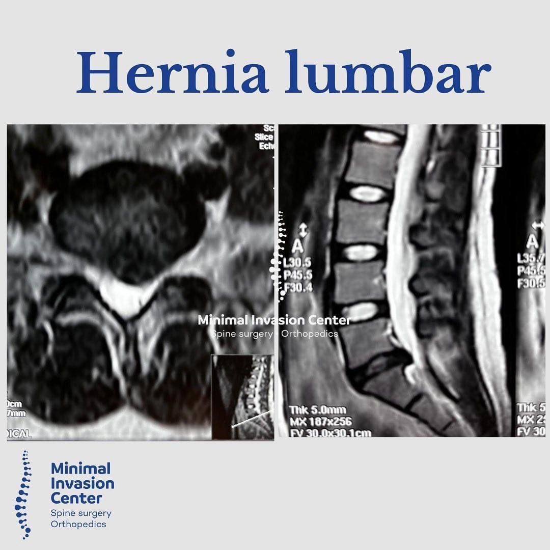 Omar Marroquín Herrera-30