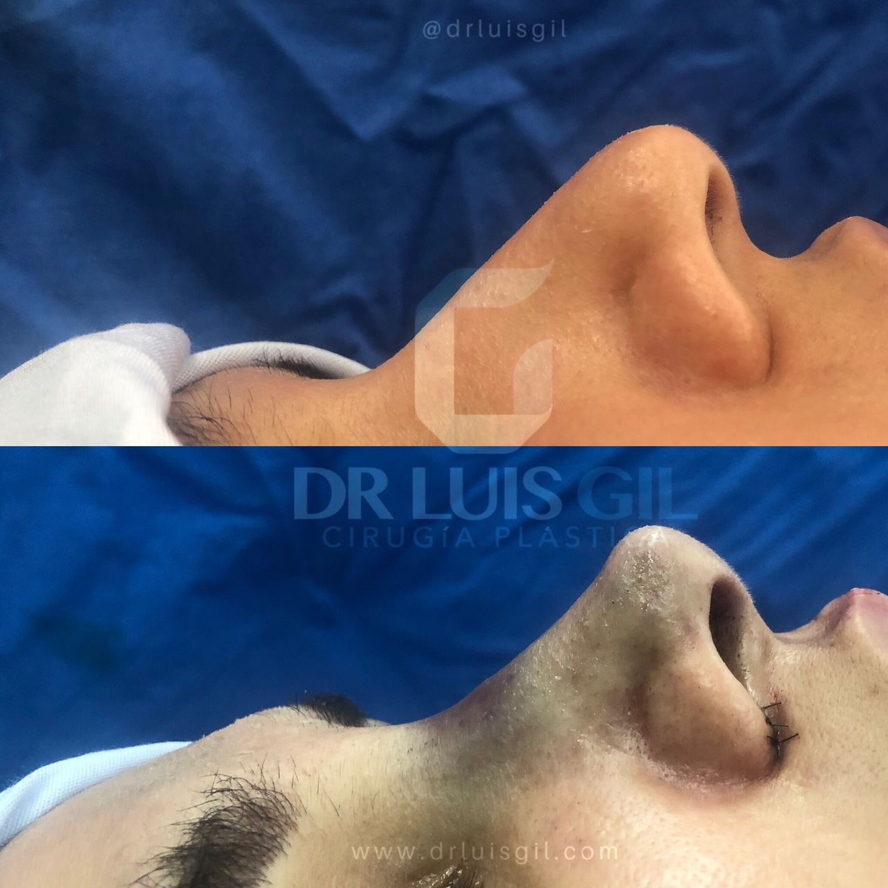 Luis Atilio Gil Pérez-22