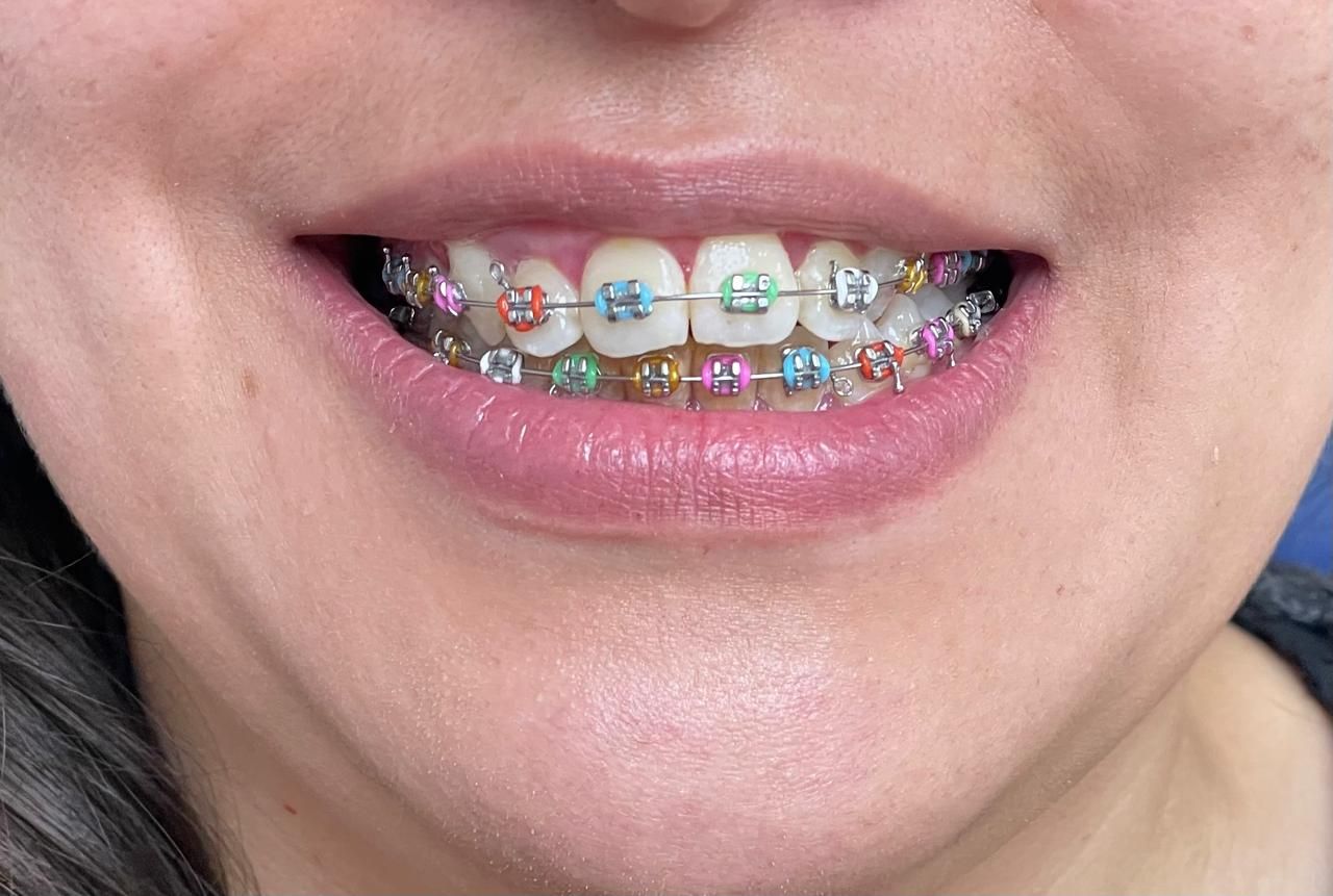 Anuar Becerril Castro-19