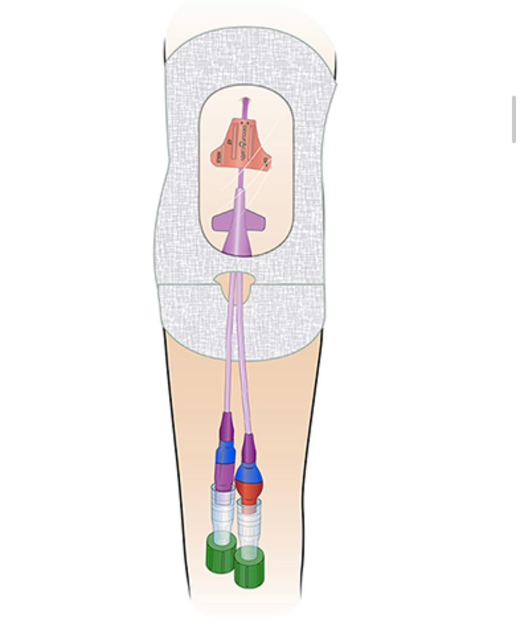 Gilberto Ramírez Pacheco-16