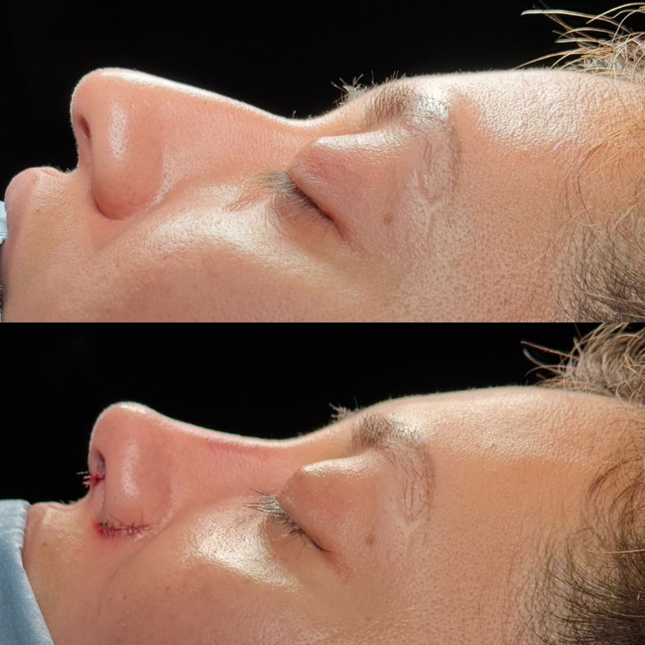 Angel Castro Urquizo-219