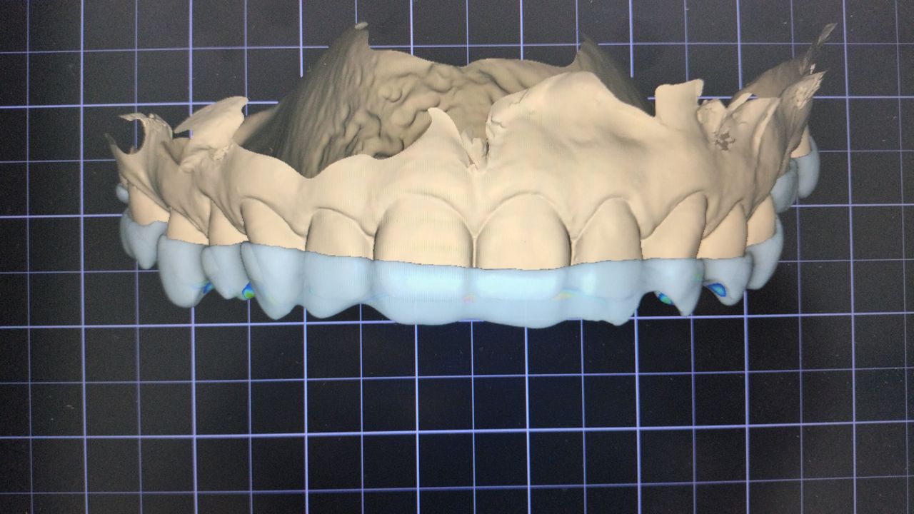 Fredy Alejandro Roblero Gónzalez-35