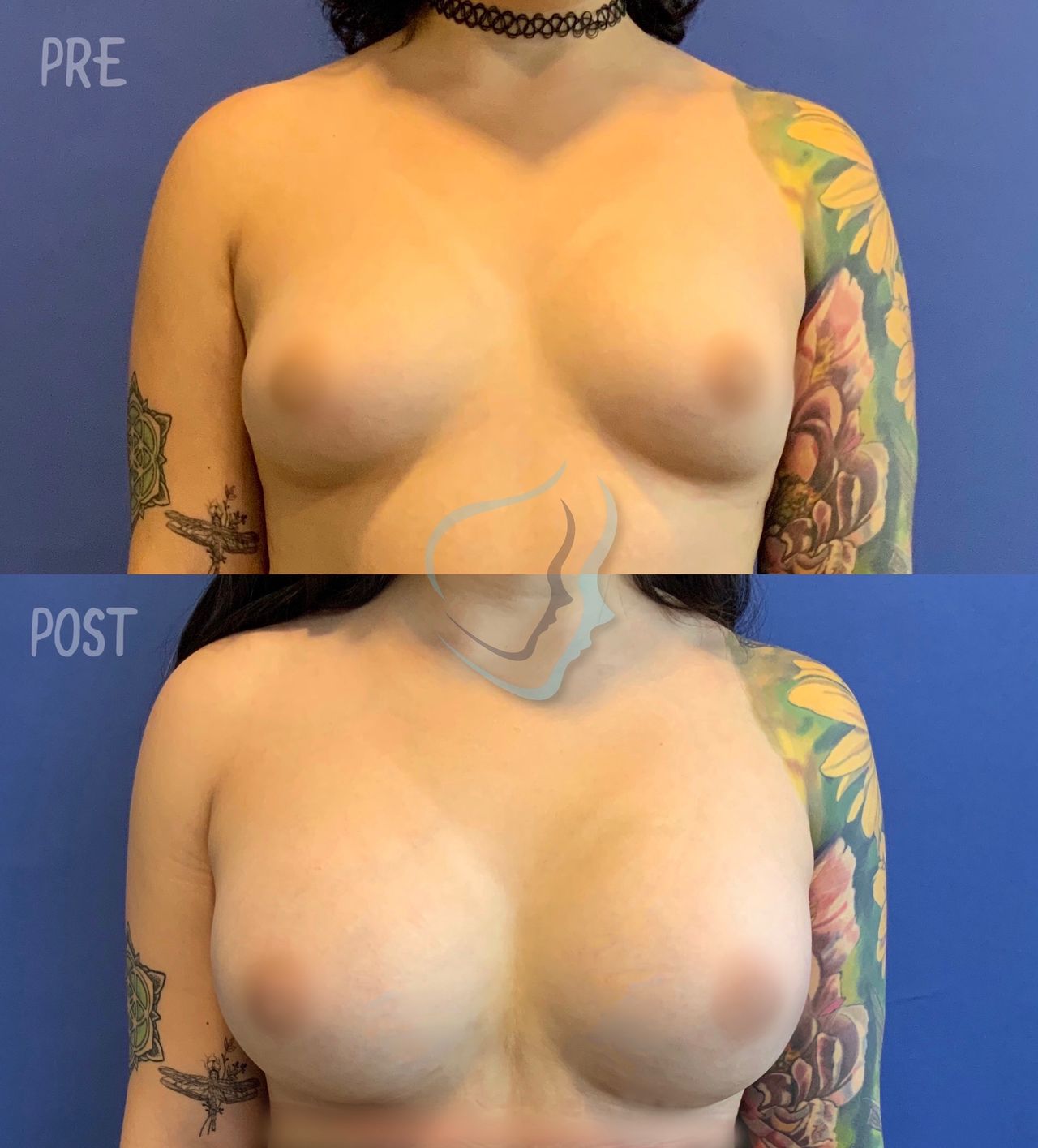 Giuseppe Tanzillo-53