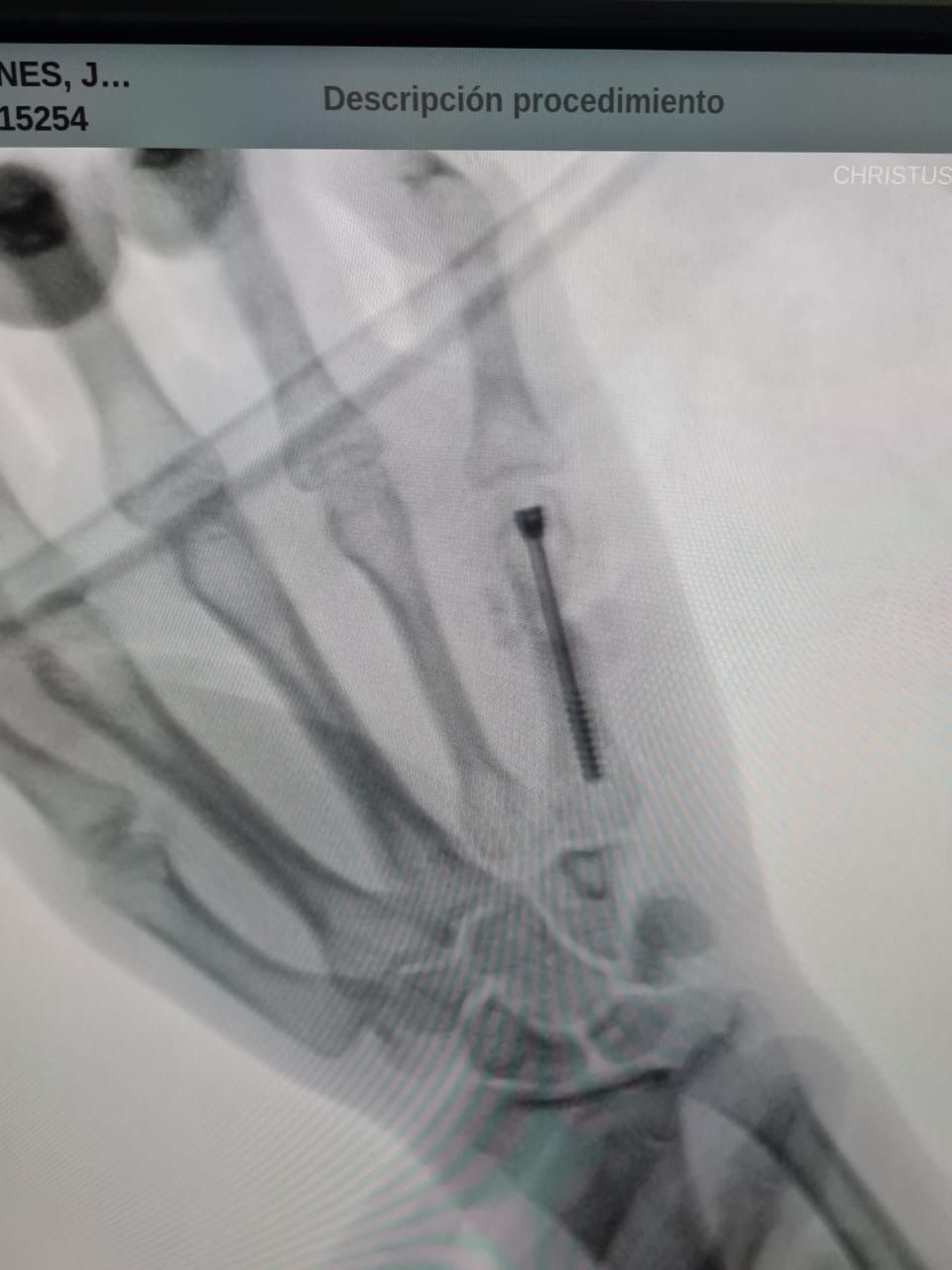 José Enrique Herrera Mesino-8