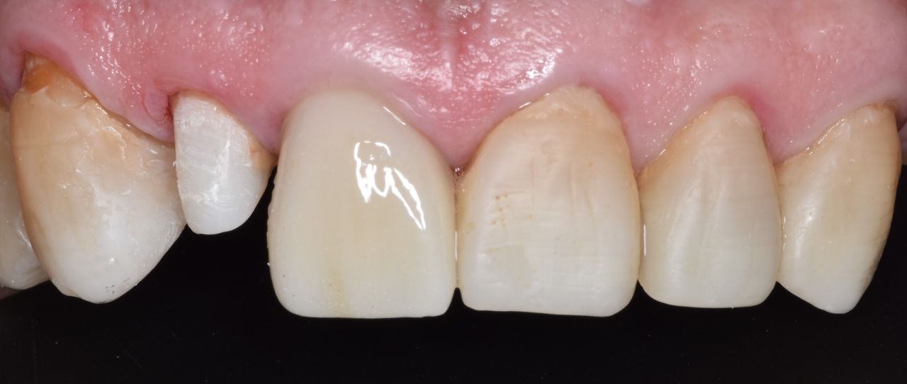 Xavier Iván Borges Cuevas-2