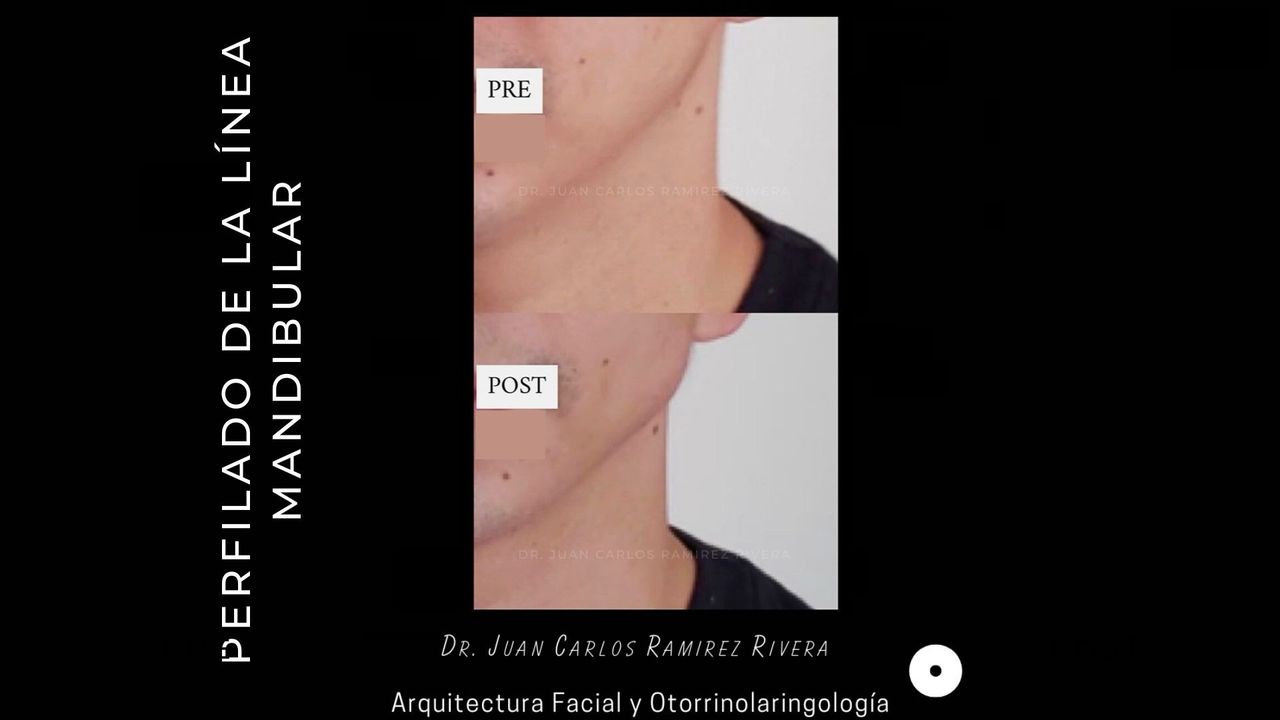 Juan Carlos Ramirez Rivera-9