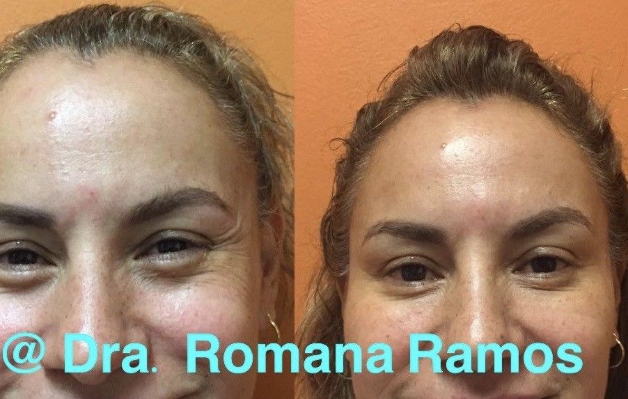 Romana Ramos Cárdenas-9