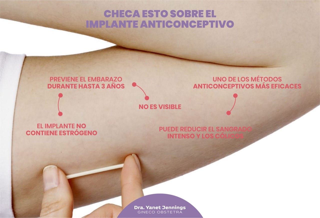 Yanet Jennings Aguilar-14