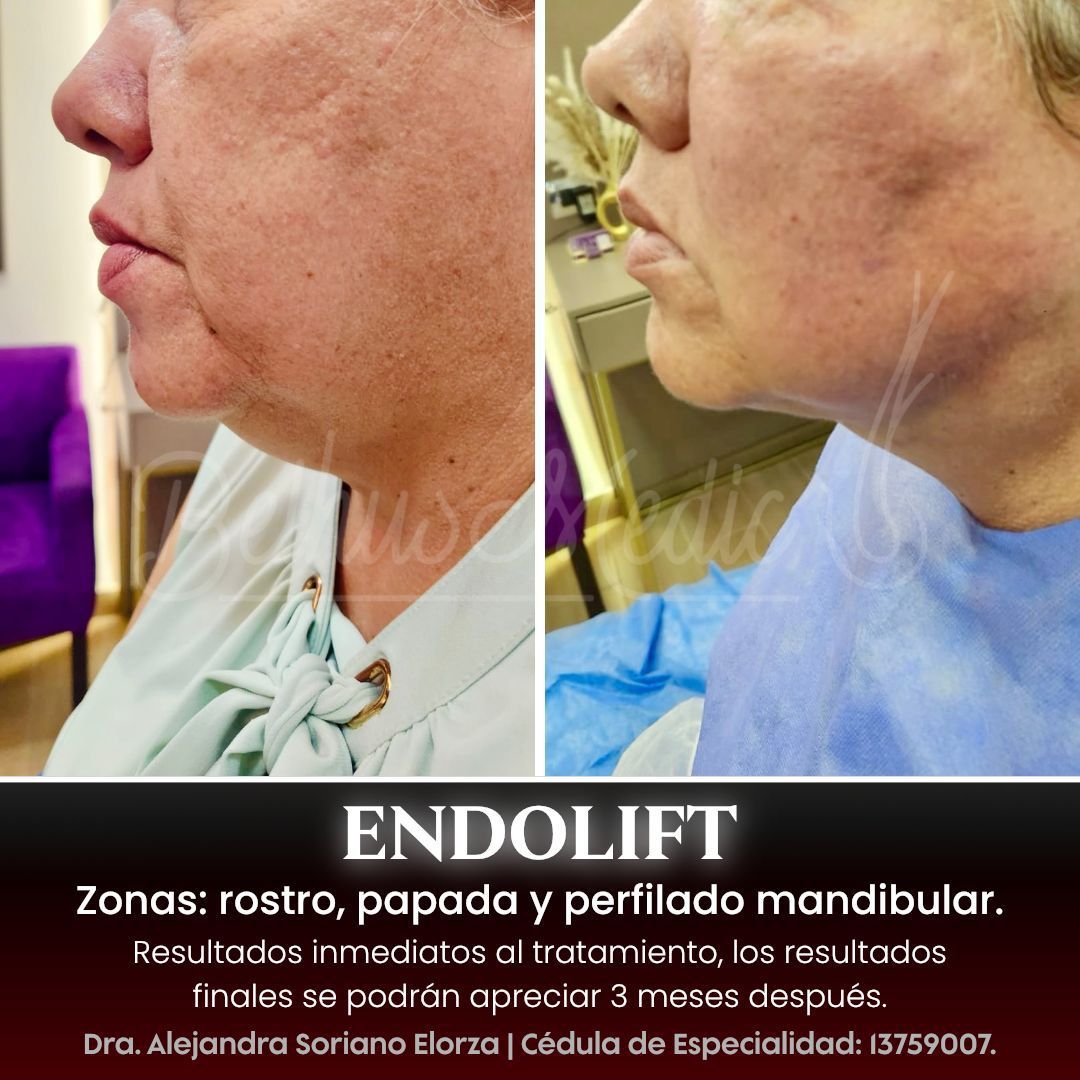 Alejandra Soriano Elorza-67