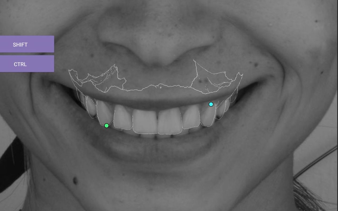 Fredy Alejandro Roblero Gónzalez-31