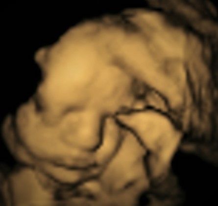 Manuel Pérez Morales-16