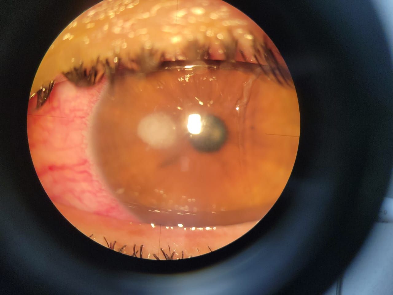 Blanca Esmeralda Hurtado Noriega-4