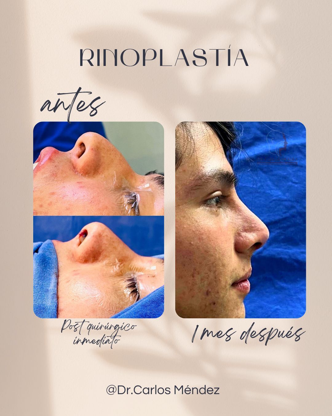 Juan Carlos Mendez Gutierrez-15