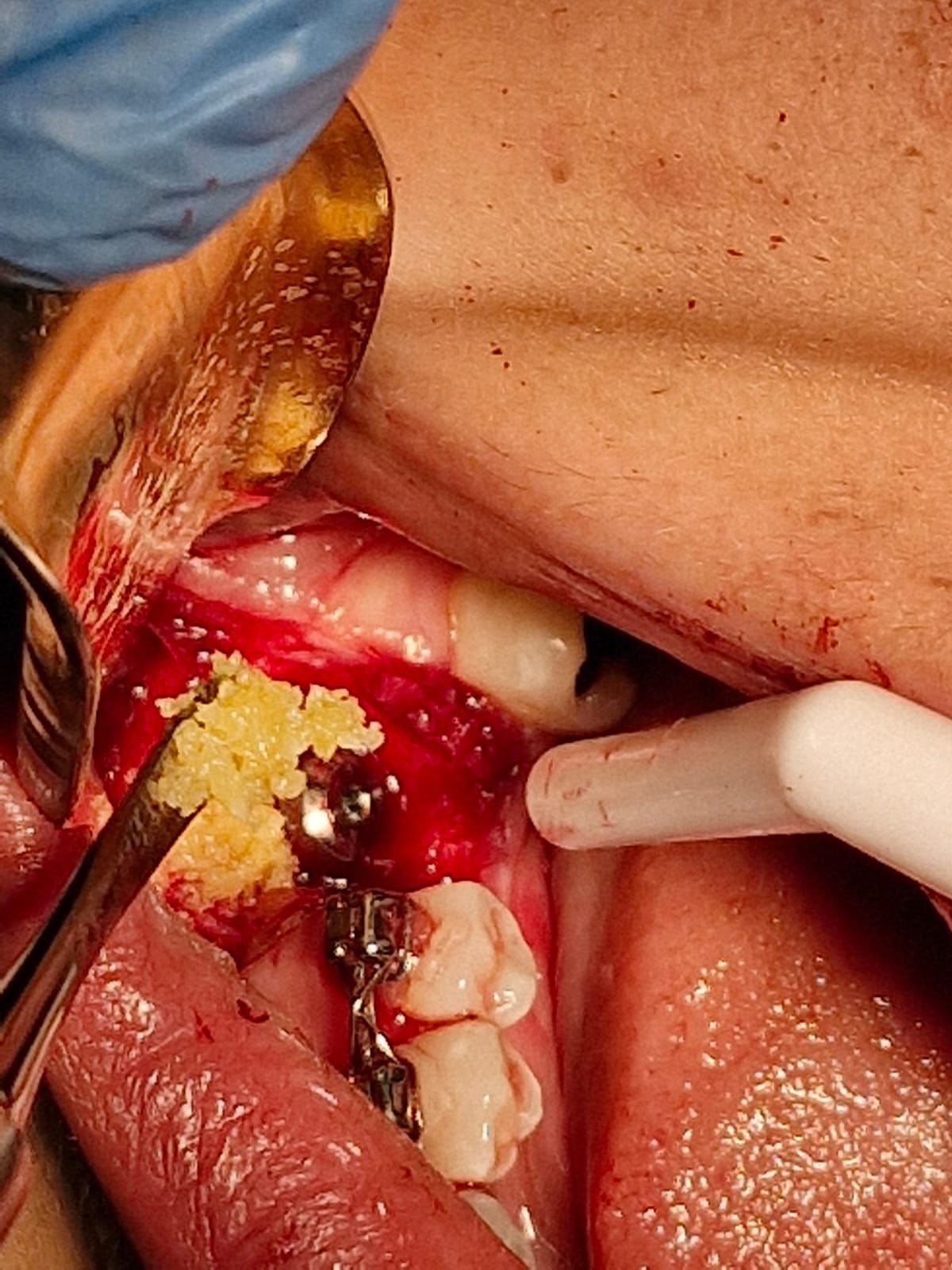 Jair Contreras García-31