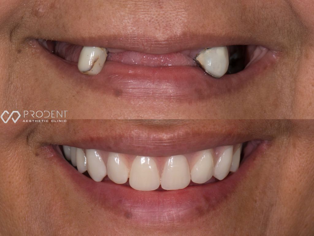 Ulises Pérez Murillo-40