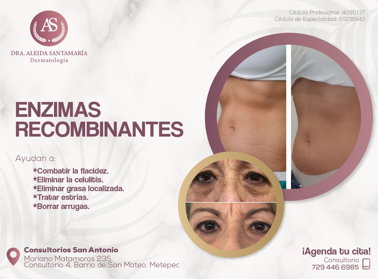 Aleida Santamaria Roman-13