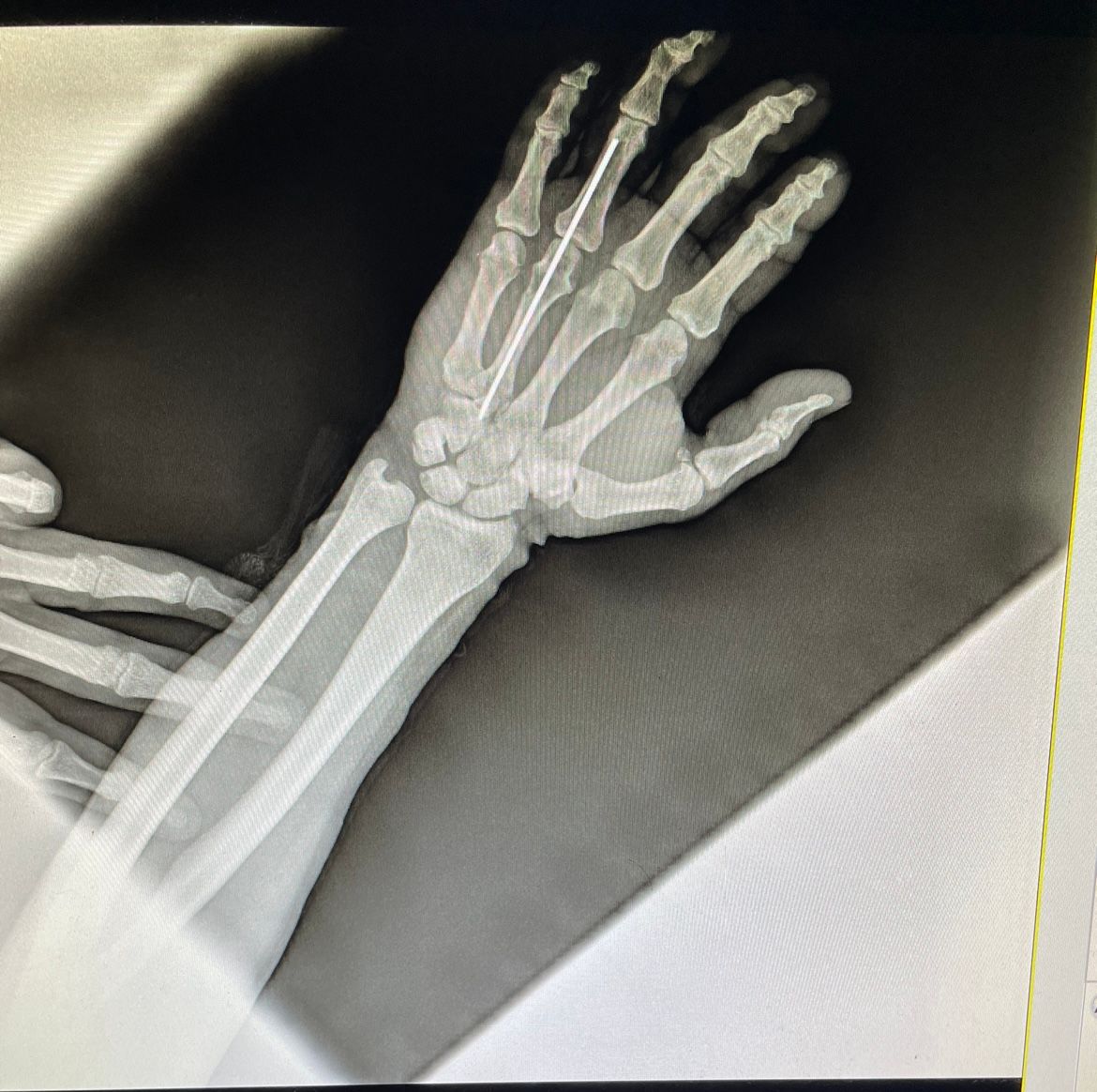 Luis Alberto Monge Bravo-1