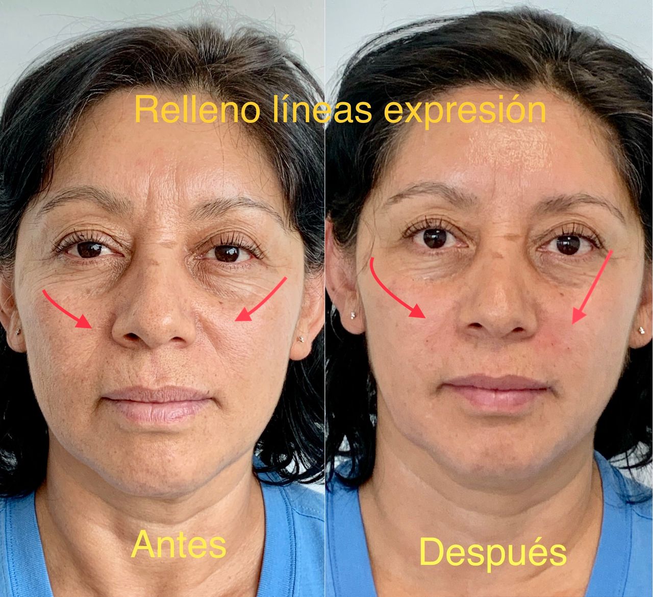 Ana Guadalupe Torres León-6