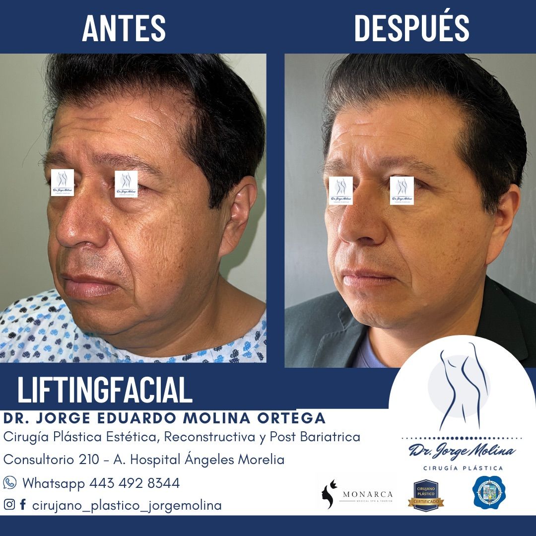 Jorge Eduardo Molina Ortega-14