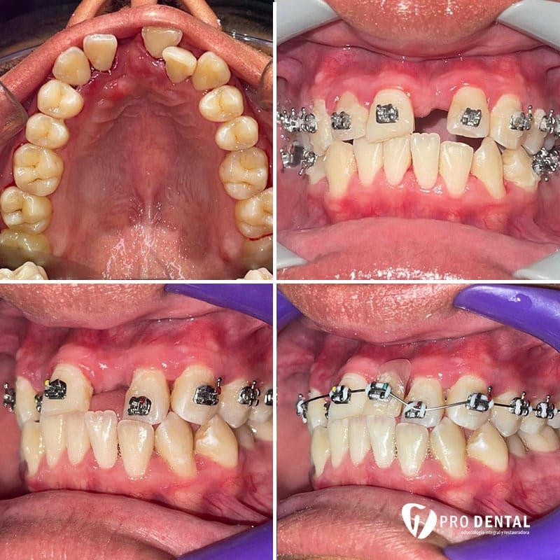 Maria Del Carmen Canul Guzman-1