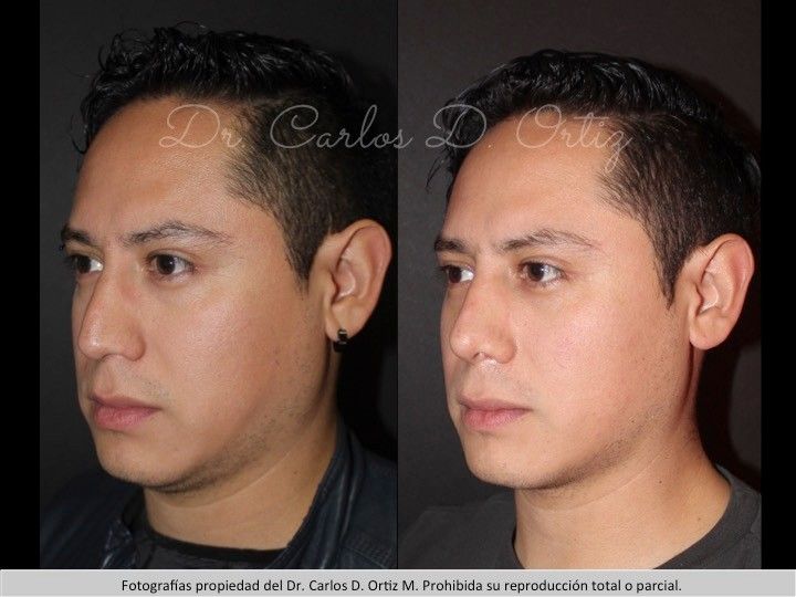 Carlos David Ortiz Moreno-7