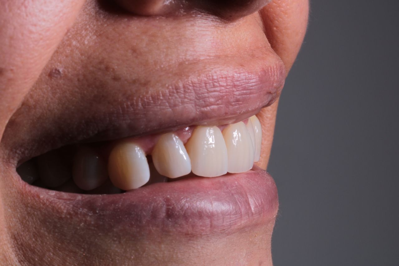 David Alan Escamilla Álvarez-3