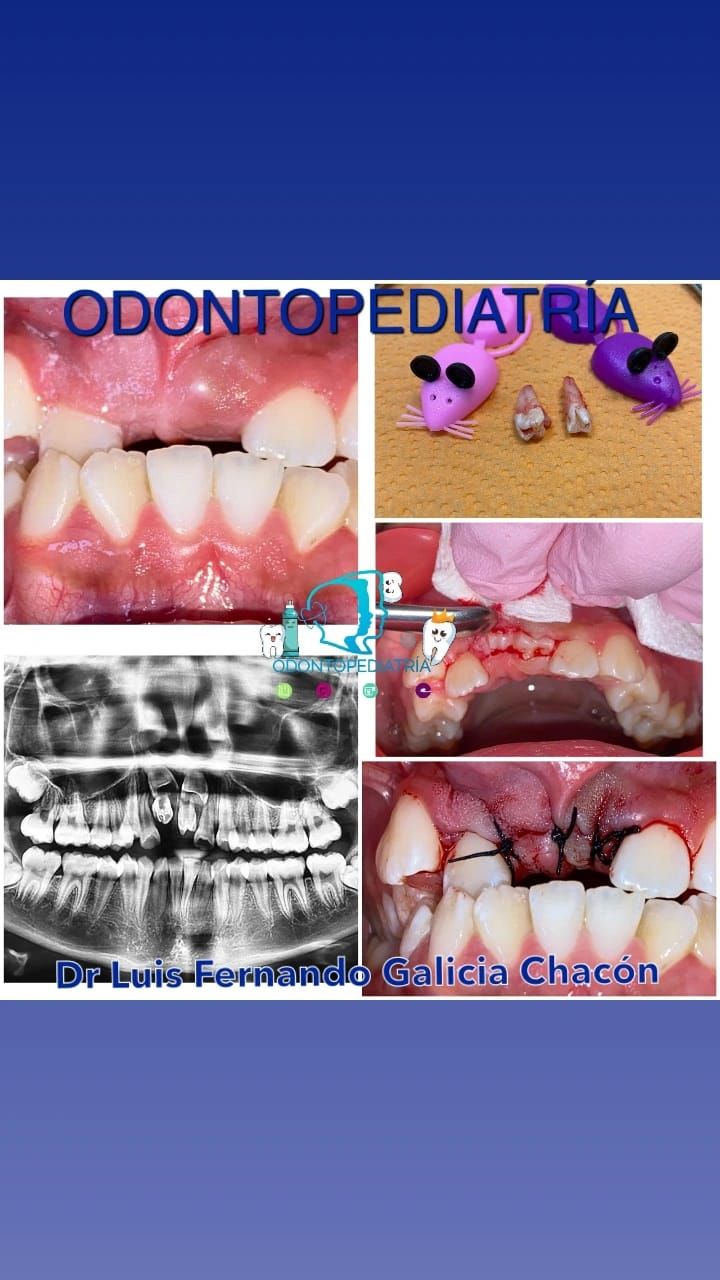 Luis Fernando Galicia Chacón-28