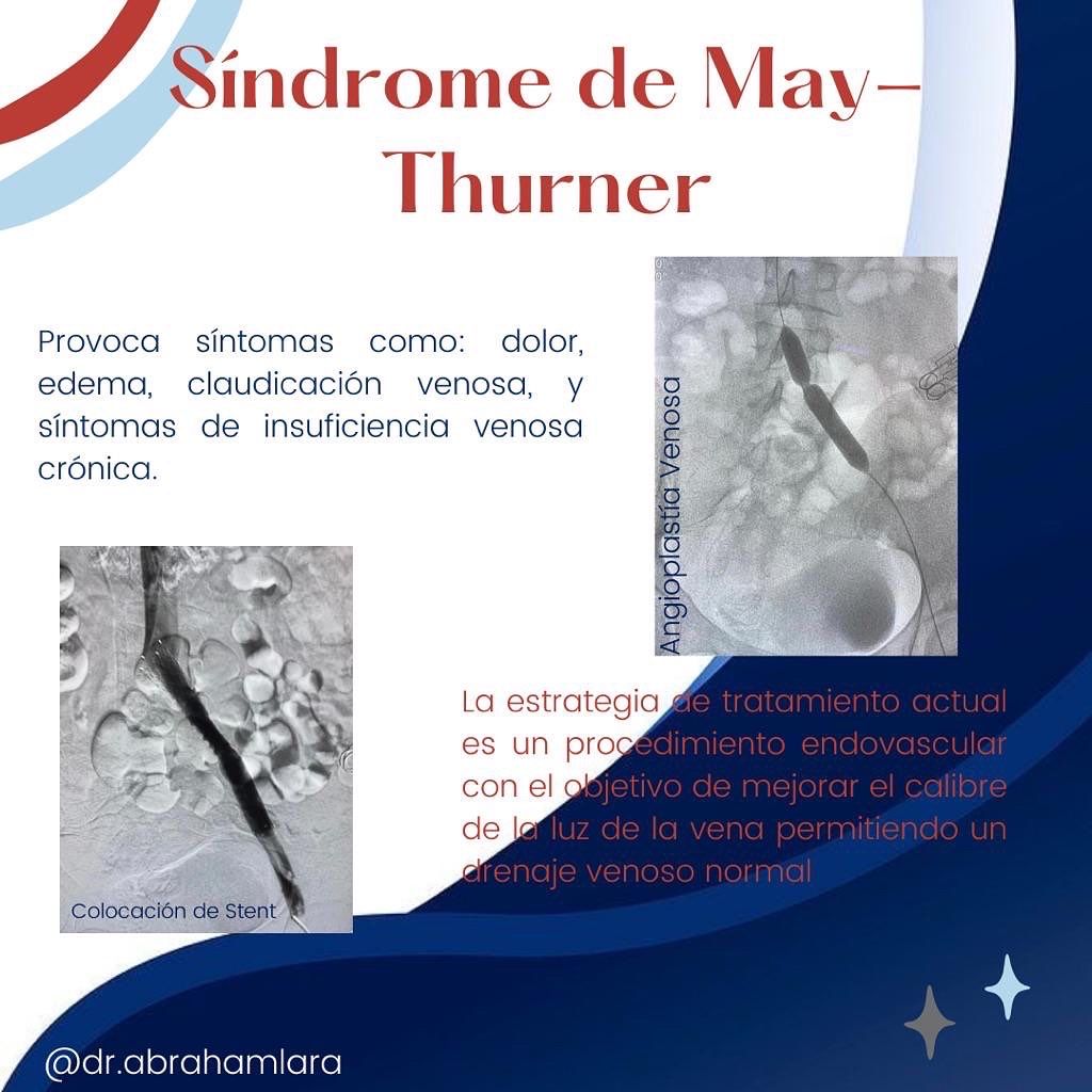 Miguel Abraham Lara Perez-22