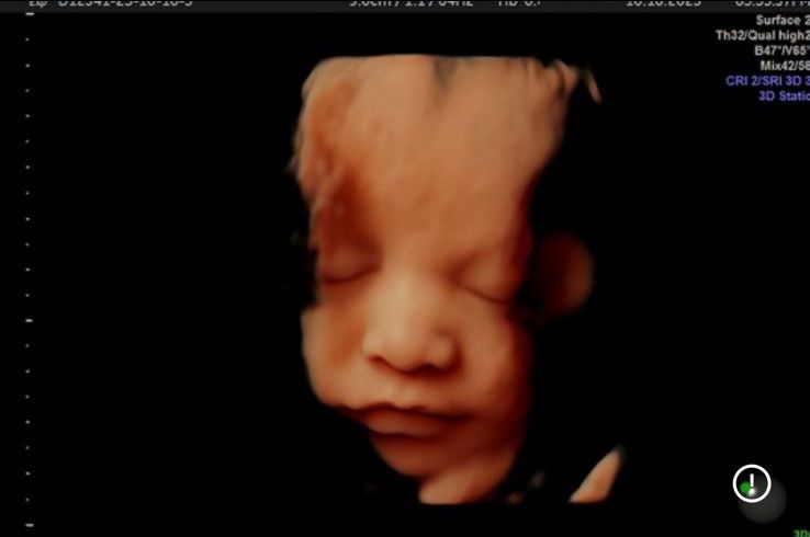 Graciela Elizabeth De La Torre Alvarez-30