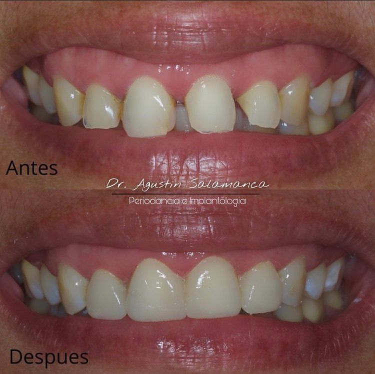 Agustin Salamanca Tapia-8