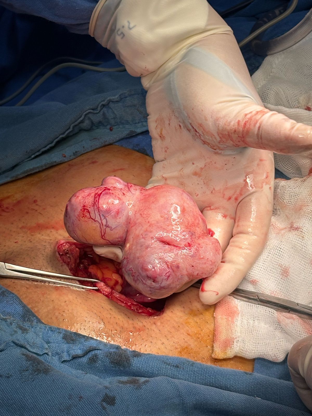 Alejandro Bailón Calderón-6