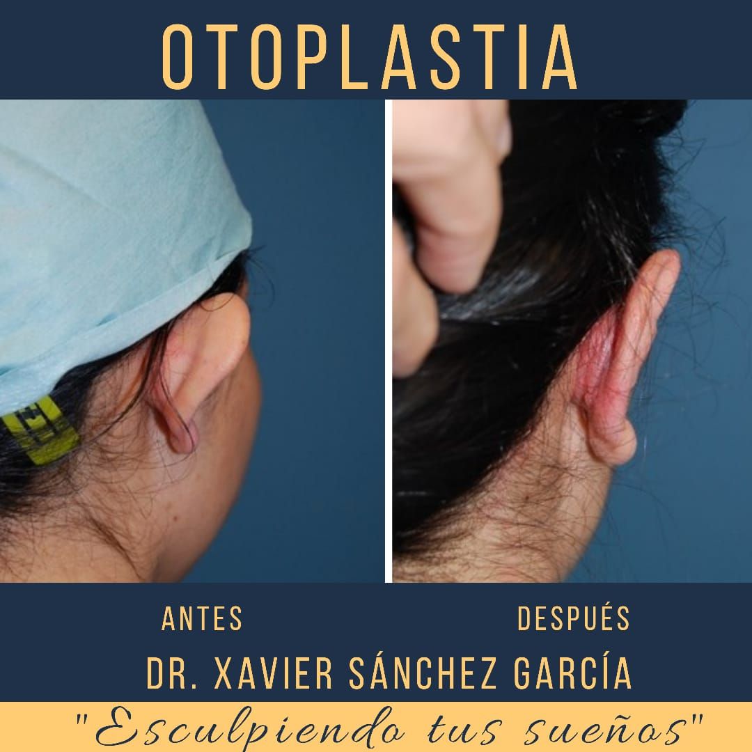 Xavier Sánchez García-45