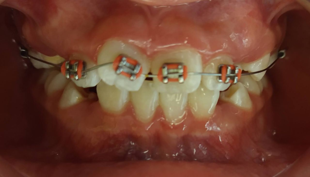 Petra Albarran Calzonzin-0