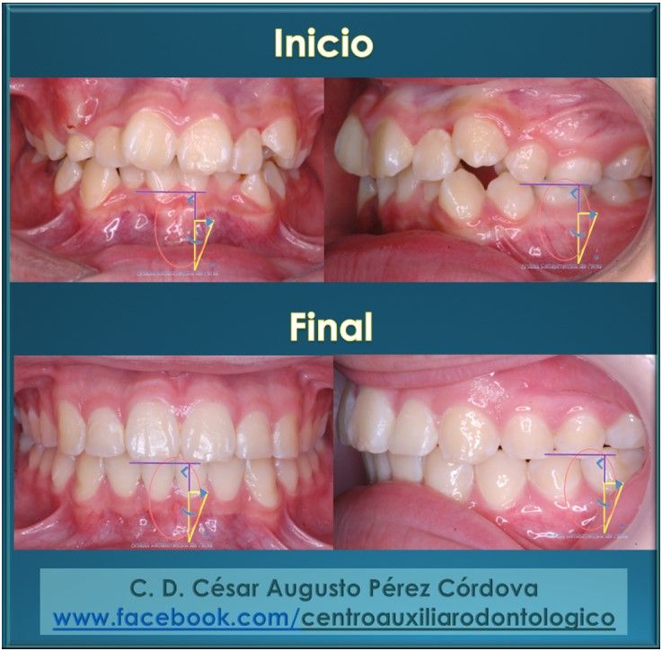 César Augusto Pérez Córdova-25