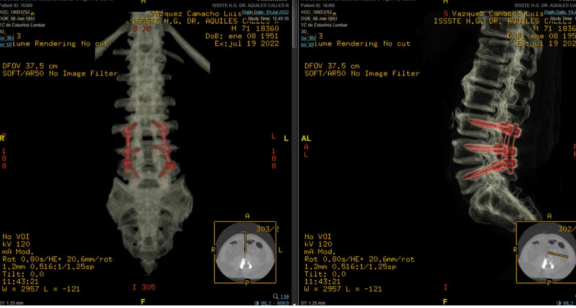 Celia Teresa De Jesús Álvarez Gamiño-15