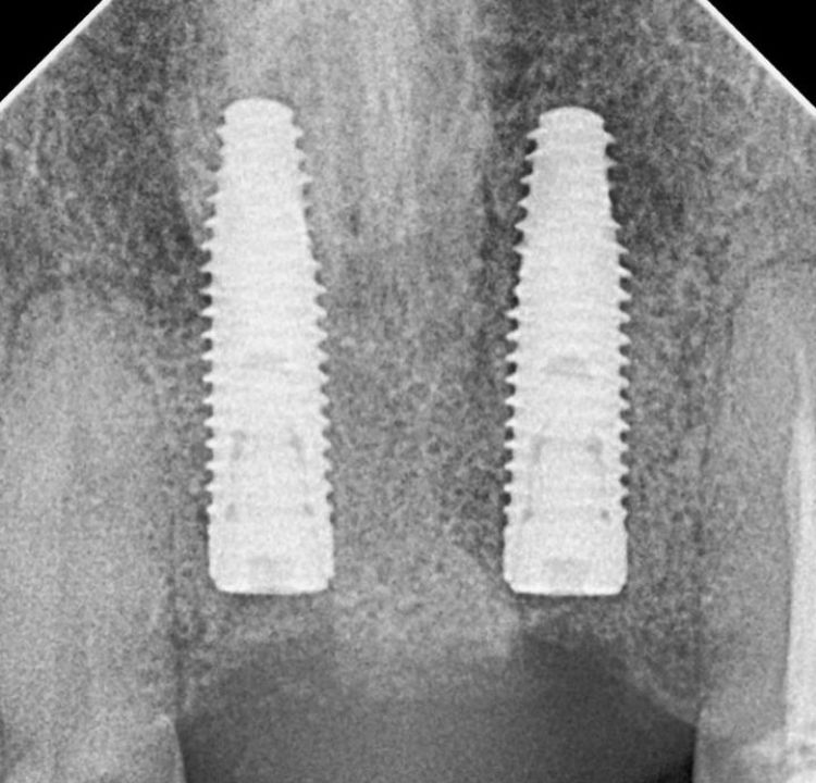 Agustin Salamanca Tapia-6