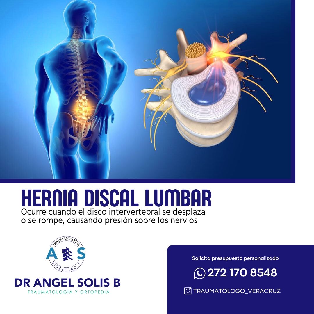 Angel Alberto Solis Barrios-9