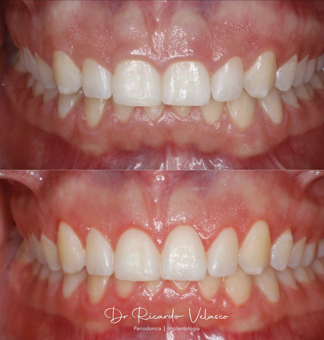 Ricardo Velasco Avelar-7